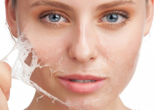 لایه برداری